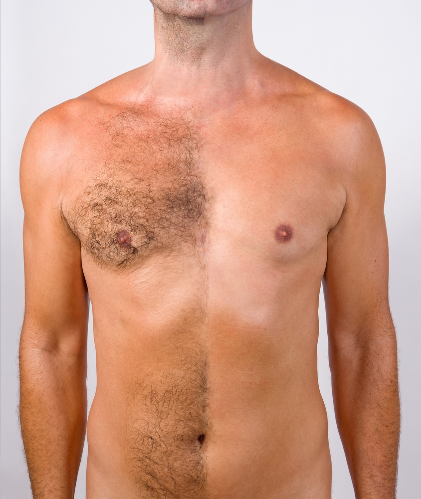 эпиляция на груди и животе у мужчин фото 11