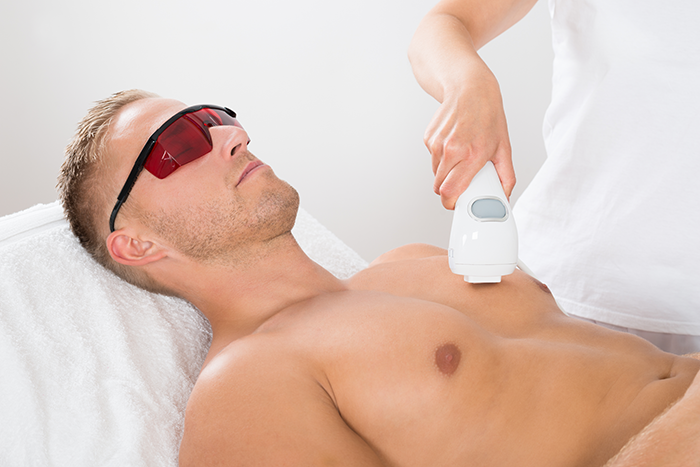 Cost of Laser Hair Removal San Diego | The Laser Cafe