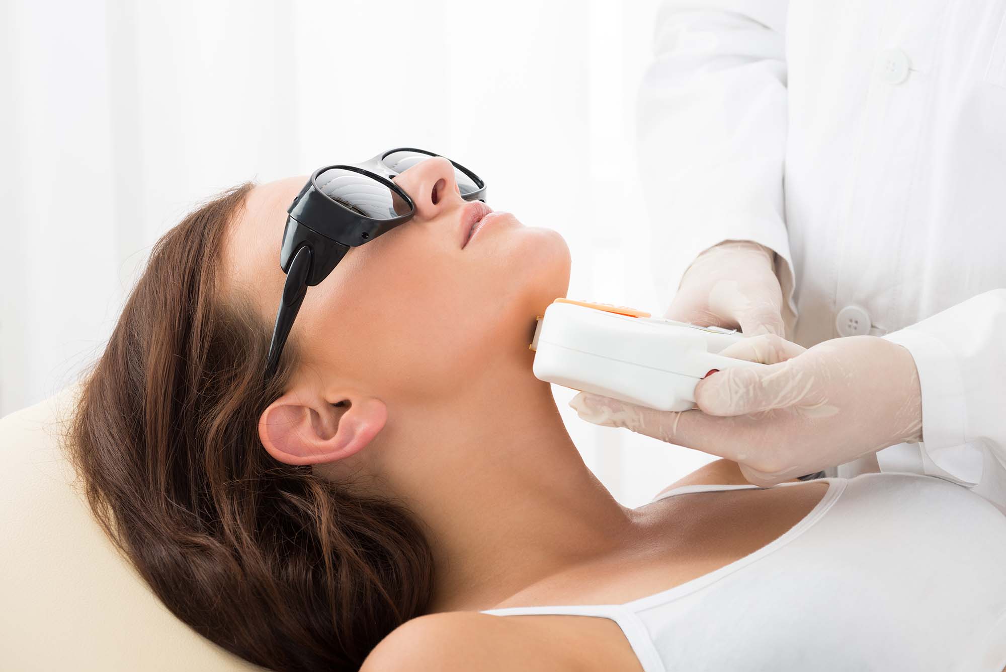 laser hair removal san diego