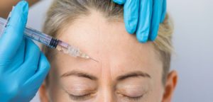 Botox for Migraines