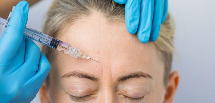 Botox for Migraines