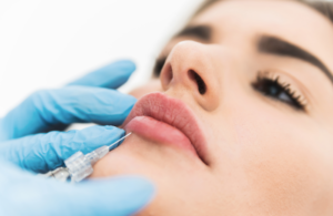 dermal fillers san diego