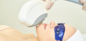 IPL Facial