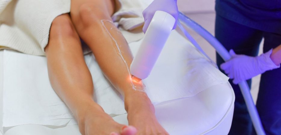 Laser Hair Removal San Diego The Laser Cafe