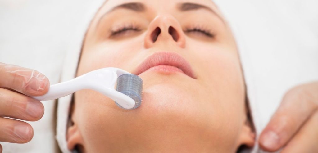 Microneedling