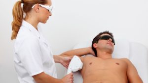 laser hair removal san diego