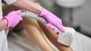 laser hair removal San Diego