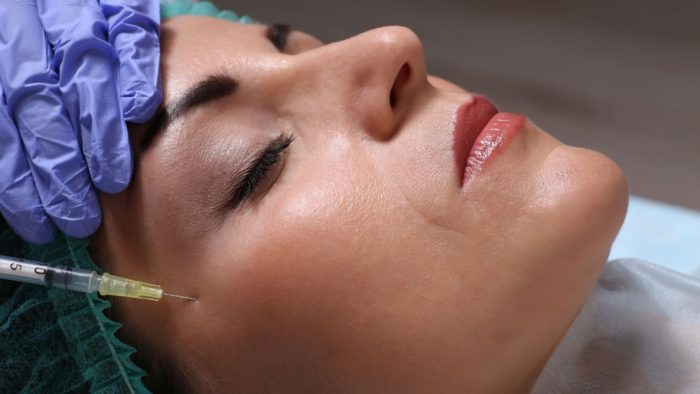 dermal fillers for acne scars