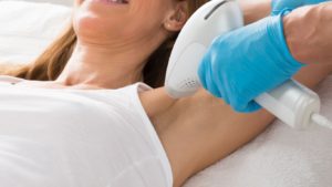 laser hair removal