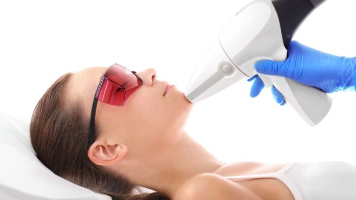 Laser Hair Removal for the Face