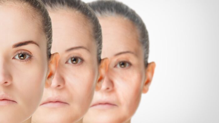 botox for aging