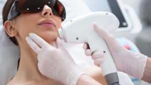 laser hair removal and hormones